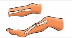 Accident And Trauma Surgery Service