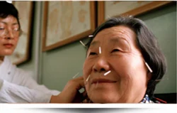 Geriatirc Acupuncture Testimonials